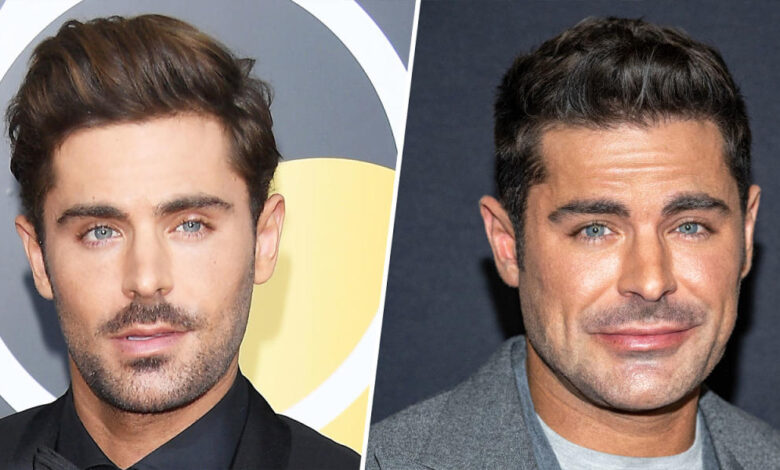 zac efron face surgery